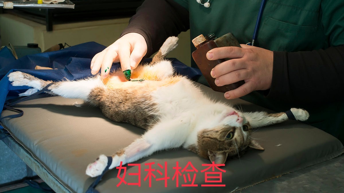 第一次在美帝做妇科检查