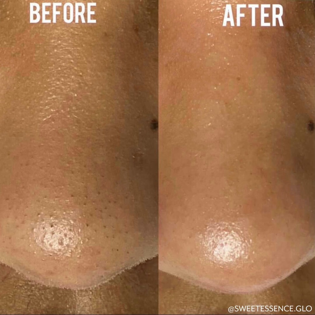 dermaflash_164107100_270135441347773_807195731098392424_n.jpg
