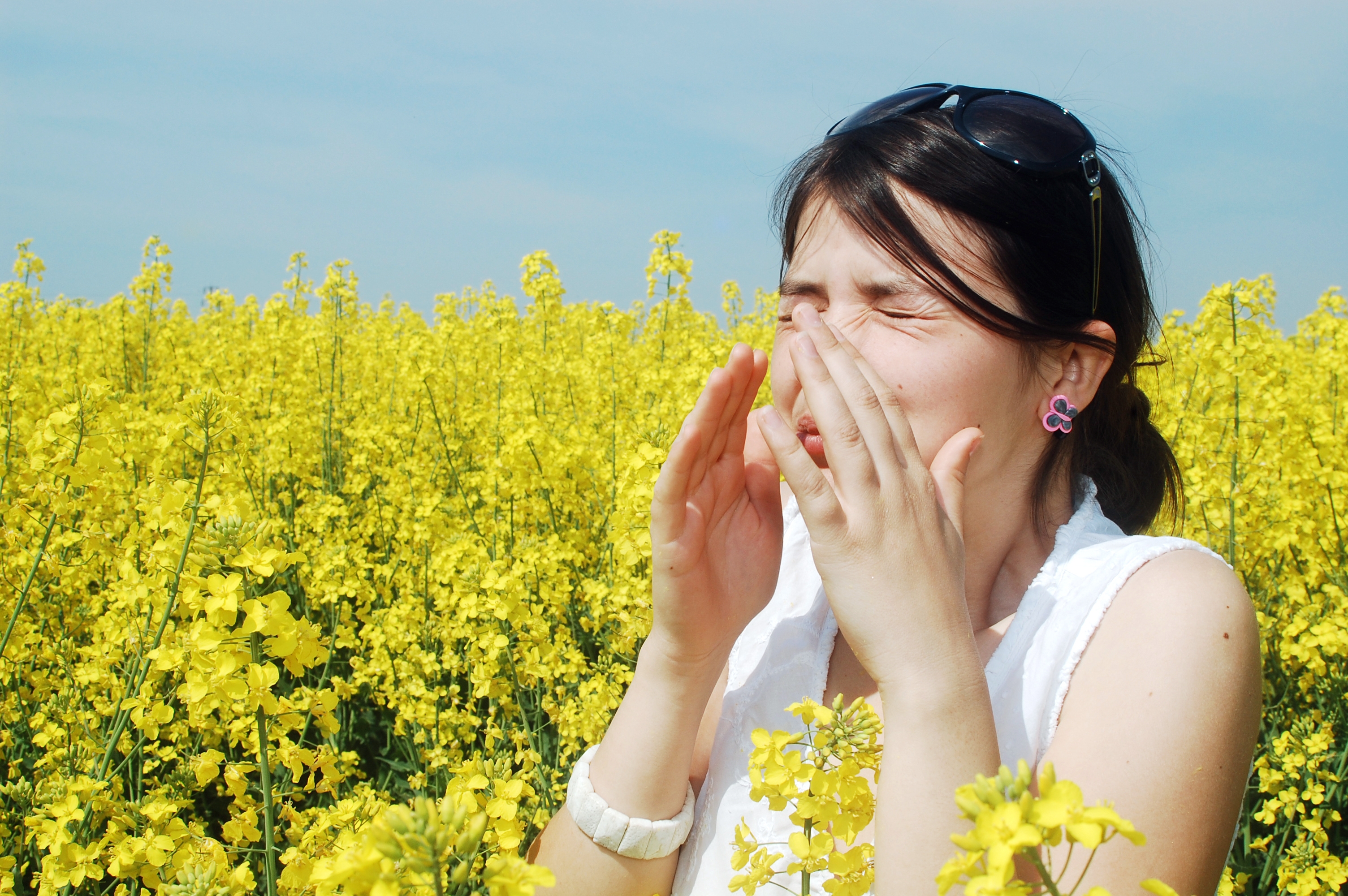 花粉症 skin rash/rash 皮肤疹 hives 荨麻疹 itching 痒 watery eyes