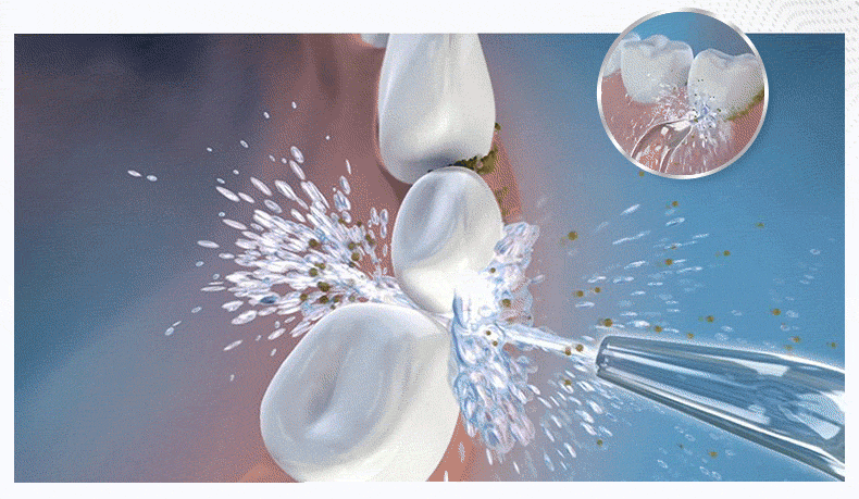 有了它就能守护牙龈 waterpik水牙线豪华套装 - 北美省钱快报